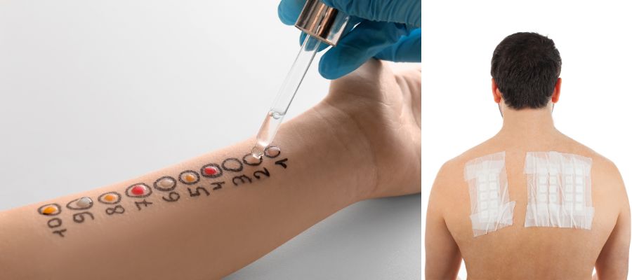 Alerji testi uygulaması İzmir’de Dr. Orhan Demirer ile ciltte alerjik reaksiyonların nedenini belirlemeye yönelik dermatolojik değerlendirme