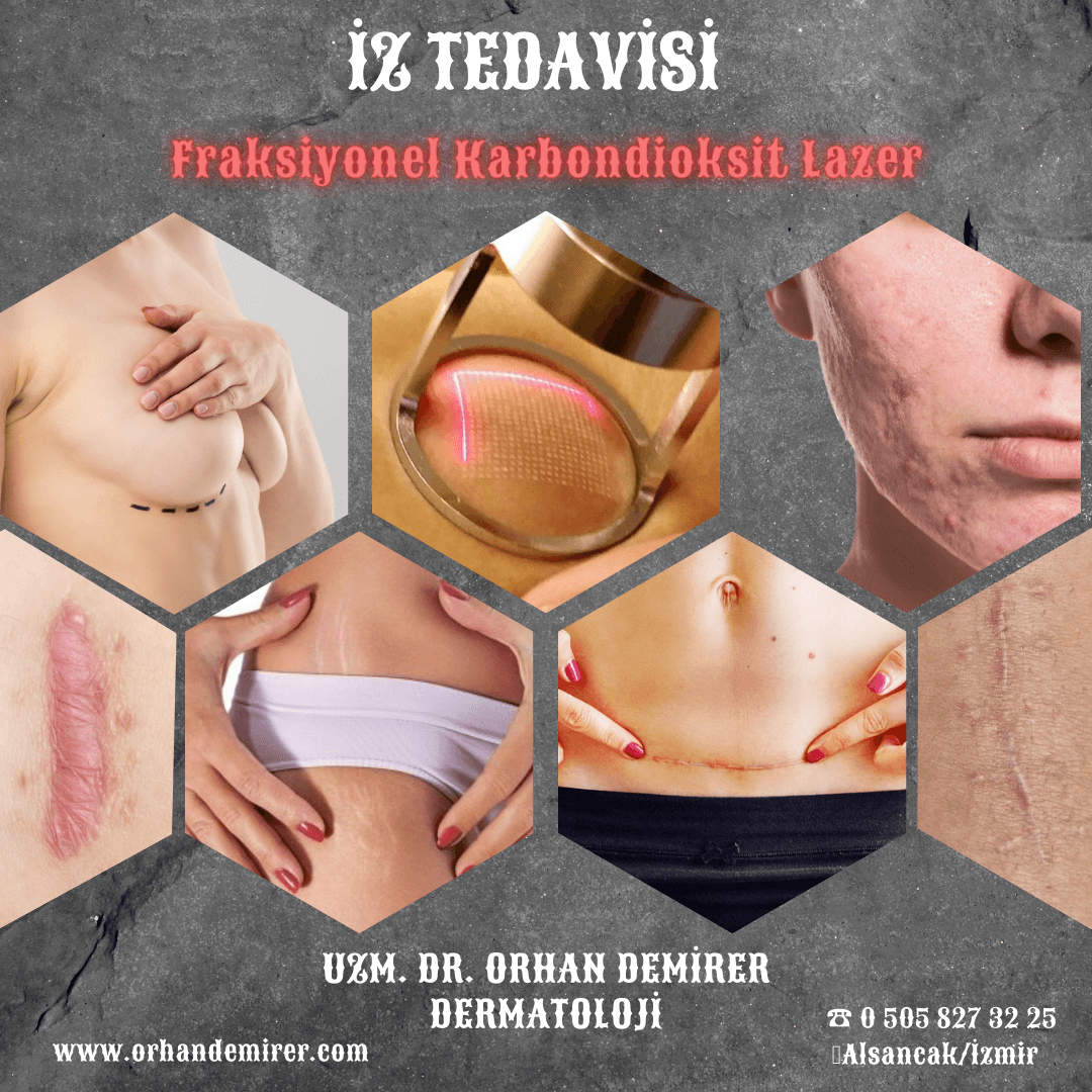 Scar treatment in Izmir with dermatologist Dr. Orhan Demirer for surgical, traumatic and raised scars