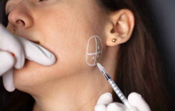 Masseter Botox in Izmir with dermatologist Dr. Orhan Demirer for bruxism, jaw clenching and prominent masseter muscles