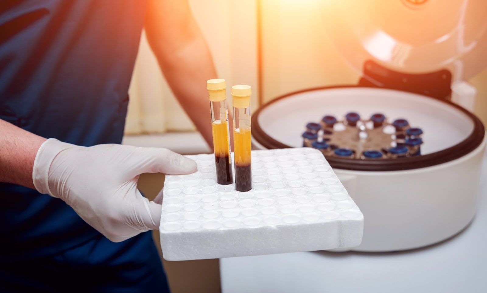 PRP treatment in Izmir with dermatologist Dr. Orhan Demirer for selected skin and hair indications after medical assessment